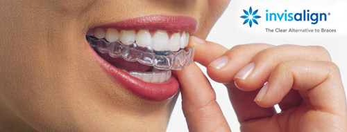 Does Wearing Invisalign® Invisible Braces Hurt? - Palm Beach Dentistry  Delray Beach Florida